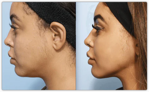 Anti-Aging Face & Neck Firming Massager ™